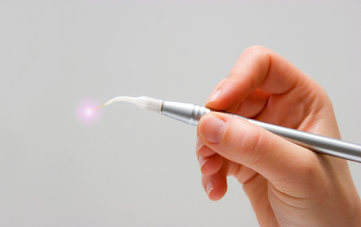 Soft tissue laser Picasso Dental Care in Temecula, CA